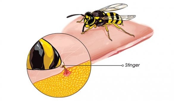 Natural Remedies For Bee Stings