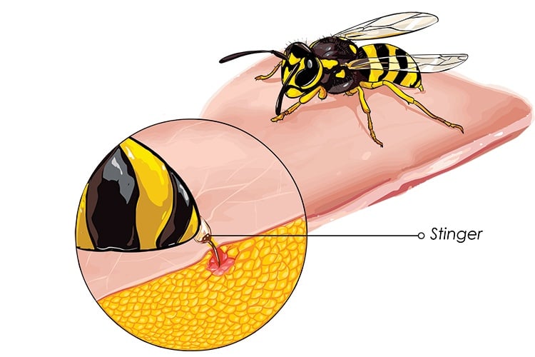 Natural Remedies For Bee Stings