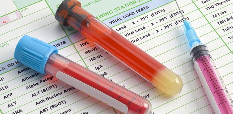 Blood Test for Drugs in System