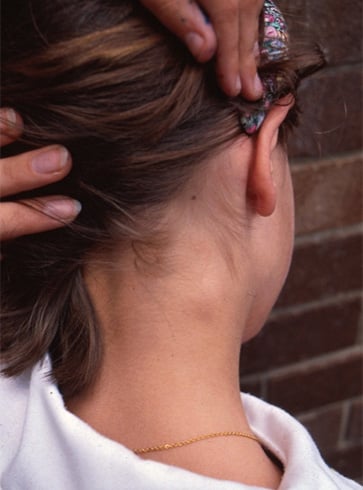 Causes of Lump behind Ear