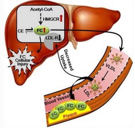 Cholesterol Control