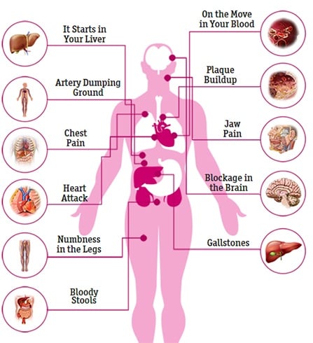 How cholesterol Affect The Body