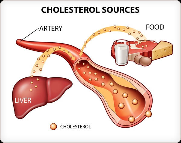 How To Reduce Cholesterol