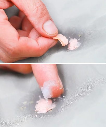 Remove Chewing Gum With Lanacane Method