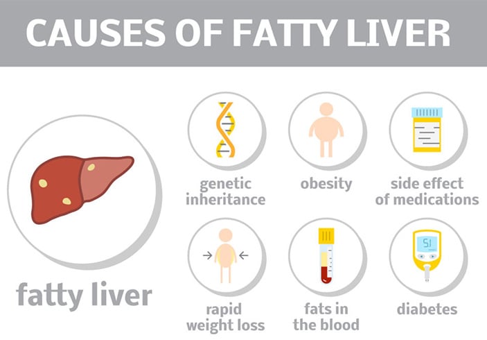 Causes Of Fatty Liver