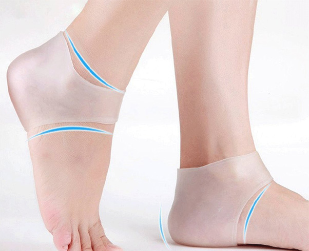 Severely Cracked Heels