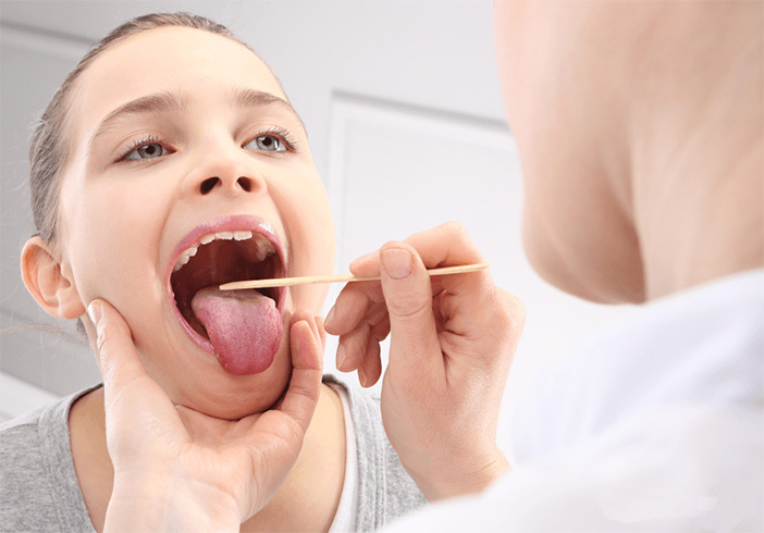 Vorbeugen tonsillensteine 9 Natürliche