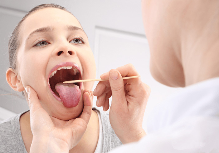 Get Rid Of Tonsil Stones For Good