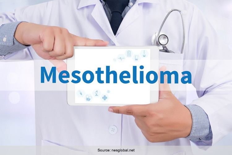 Mesothelioma Rare Cancer With No Cure