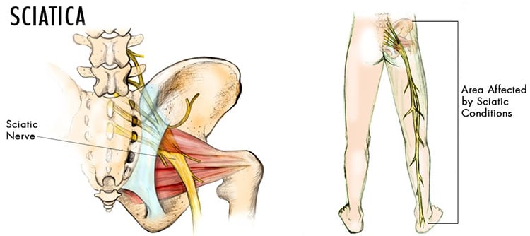 Sciatic Nerve Stretches