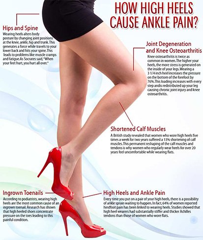 Kennen Sie diese 13 Nebenwirkungen von High Heels? 