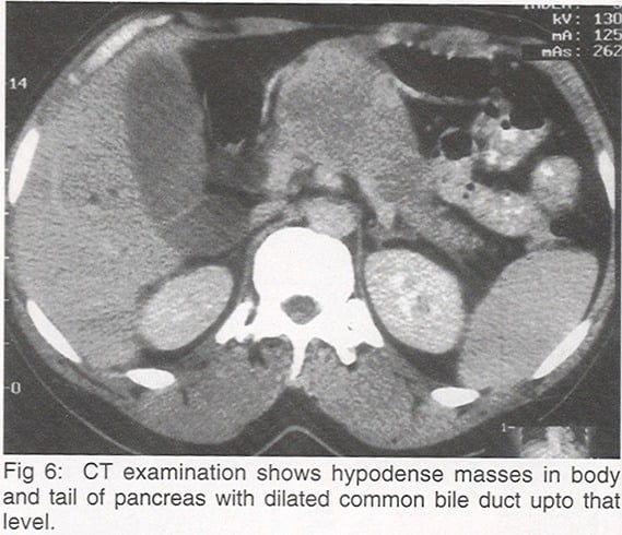 Computerized tomography (CT) scan