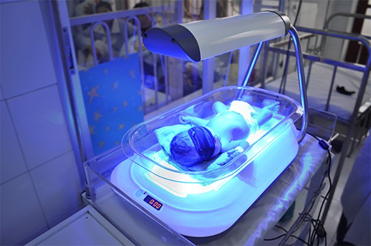 What Are Jaundice Treatments for Newborns