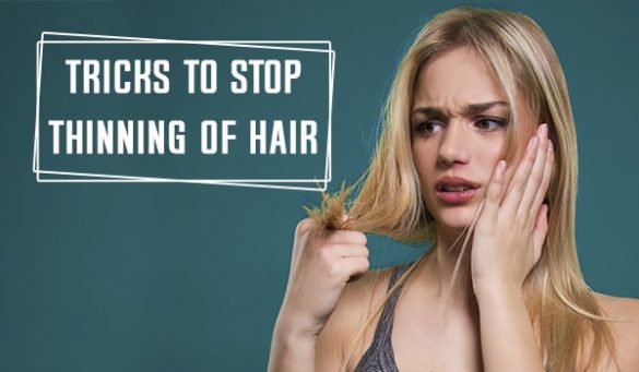 Thinning Hair
