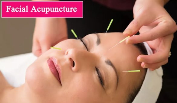 Cosmetic acupuncture for beauty