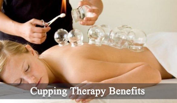 Cupping Therapy Benefits