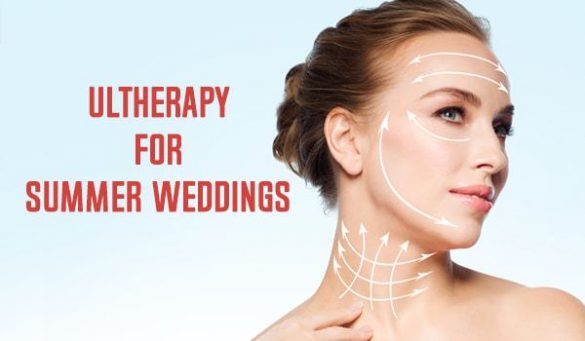 Ultherapy For Summer Weddings