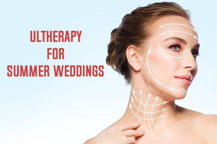 Ultherapy For Summer Weddings