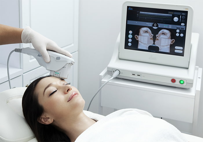 Ultherapy Treatment