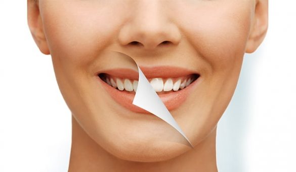 Remineralize Teeth