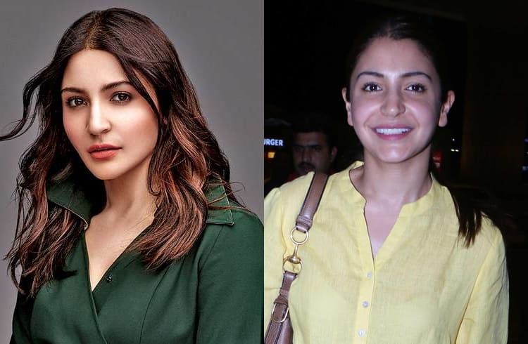 Anushka Sharma Without Makeup