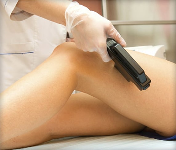 Hair Removal