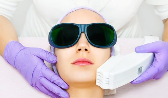 Laser Hair Removal