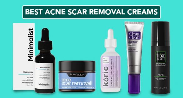 Best Acne Scar Removal Creams