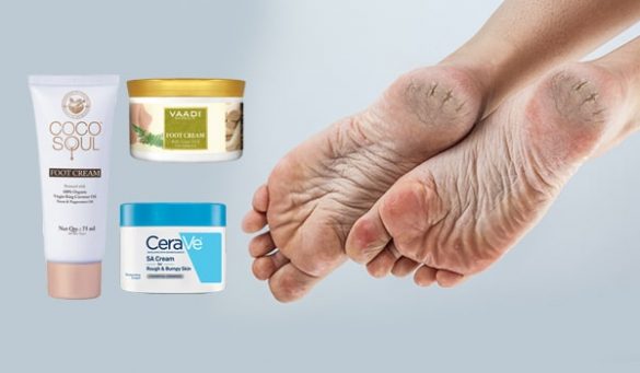 Best Creams for Cracked Heels