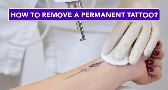 How to Remove Permanent Tattoo 10 Effective Ways to Try